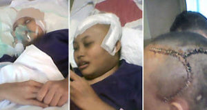 Niat Minta Bantuan Berobat Anaknya Tumor Ganas, Pensiunan Guru Ini Ditolak Temui Bupati