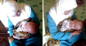 Bayi 3 Bulan Terkena Hidrosefalus, Putra Wartawan Ini Butuh Uluran Tangan