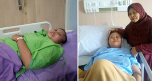 Empat Jam Setengah, Operasi Awal Pasang Selang Pipi Winda Lestari Berjalan ‘SUKSES’