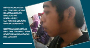 Hasil Diagnosa Cicendo, Tumor Bersarang di Pangkal Hidung, Agus Menanti Uluran Tangan