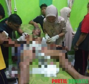 Warga Desa Gading Jaya Alami Luka Serius Usai Diterkam Dan Berkelahi Dengan Buaya