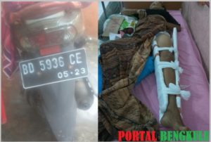 Diseruduk Motor, IRT Asal Desa Tanjung Aur 1 Dikabarkan Patah Kaki