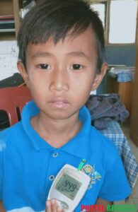 Menderita Diabetes Tipe 1, Bocah Asal Desa Kota Donok Butuh Uluran Tangan